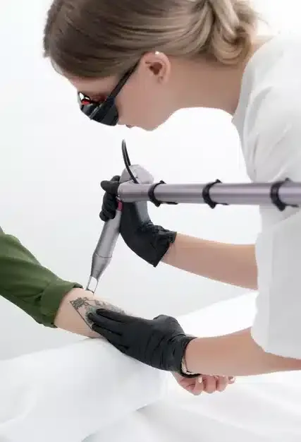Laser tattoo removal service for all skin types at OC Weight Loss and MedSpa