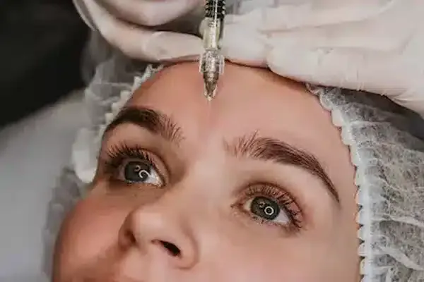 Baby Botox — before-and-after of forehead and glabella with preserved expression, OC Weight Loss and Medspa