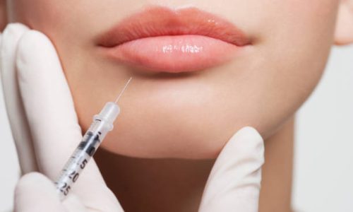 Botox injections for smoothing fine lines and wrinkles at OC Weight Loss and MedSpa in Orange County