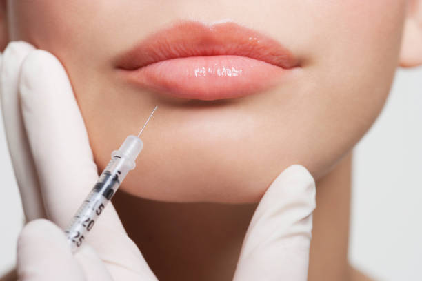 Botox injections for smoothing fine lines and wrinkles at OC Weight Loss and MedSpa in Orange County