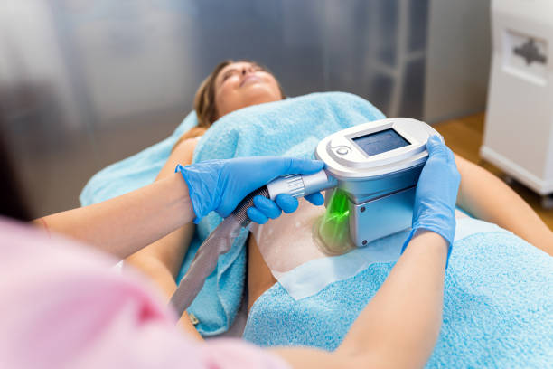 CoolSculpting procedure to eliminate stubborn fat pockets at OC Weight Loss and MedSpa