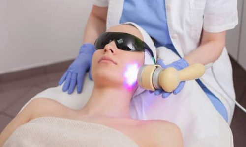 Face skin care. Woman getting facial laser treatment