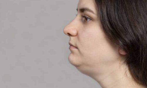 Non-surgical solutions for sagging skin and facial rejuvenation at OC Weight Loss and MedSpa