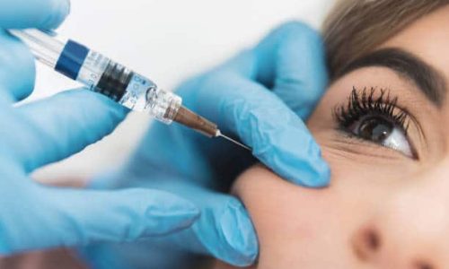 Close up of young woman having cheek fillers done.