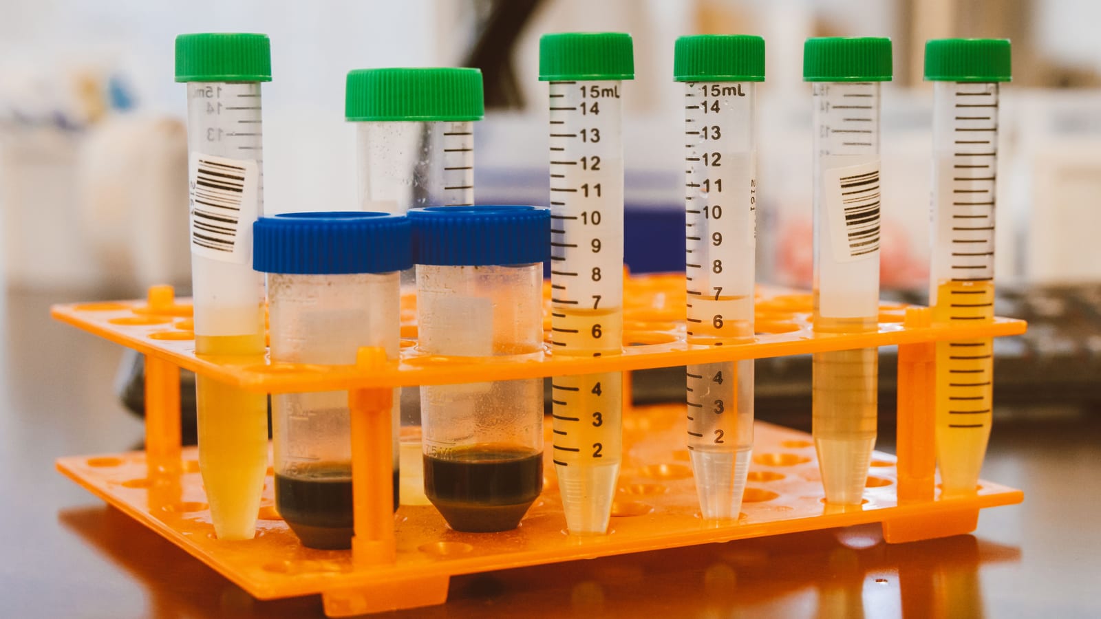 Benchtop centrifuge and collection tubes in a clinic laboratory — glp-1 hair loss at OC Weight Loss & Med Spa, Mission Viejo