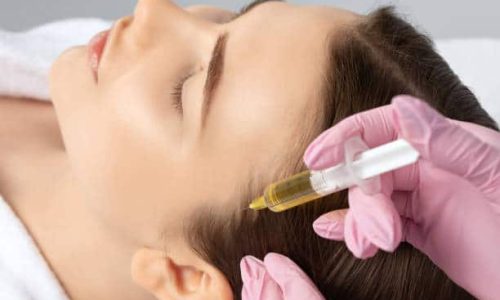 hair restoration prp