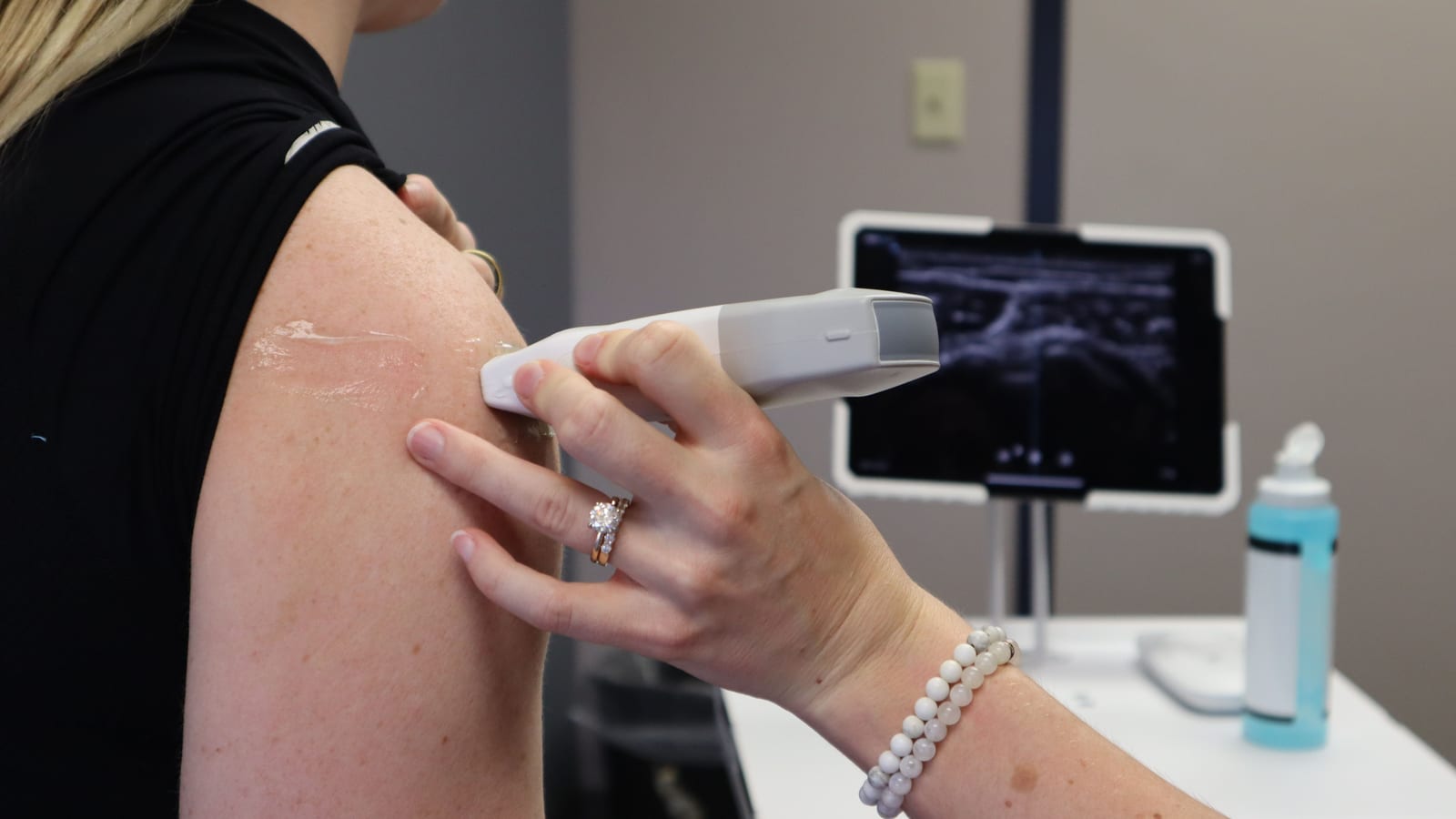 Laser handpiece and console in a treatment room — laser hair removal in aliso viejo at OC Weight Loss & Med Spa, Mission
