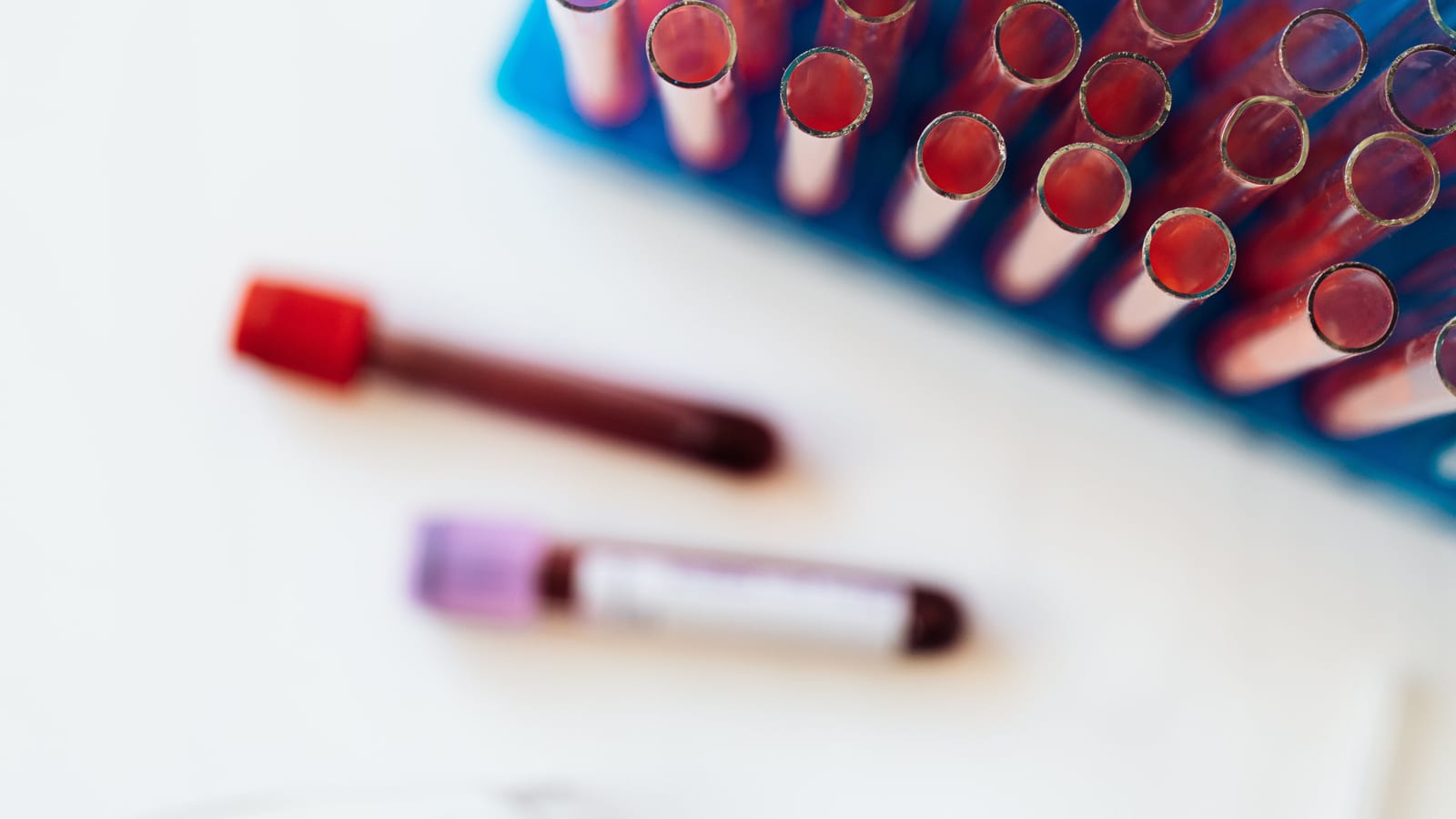 Small glass vials in a tray on a clean counter — peptide therapy in mission viejo at OC Weight Loss & Med Spa, Mission Viejo
