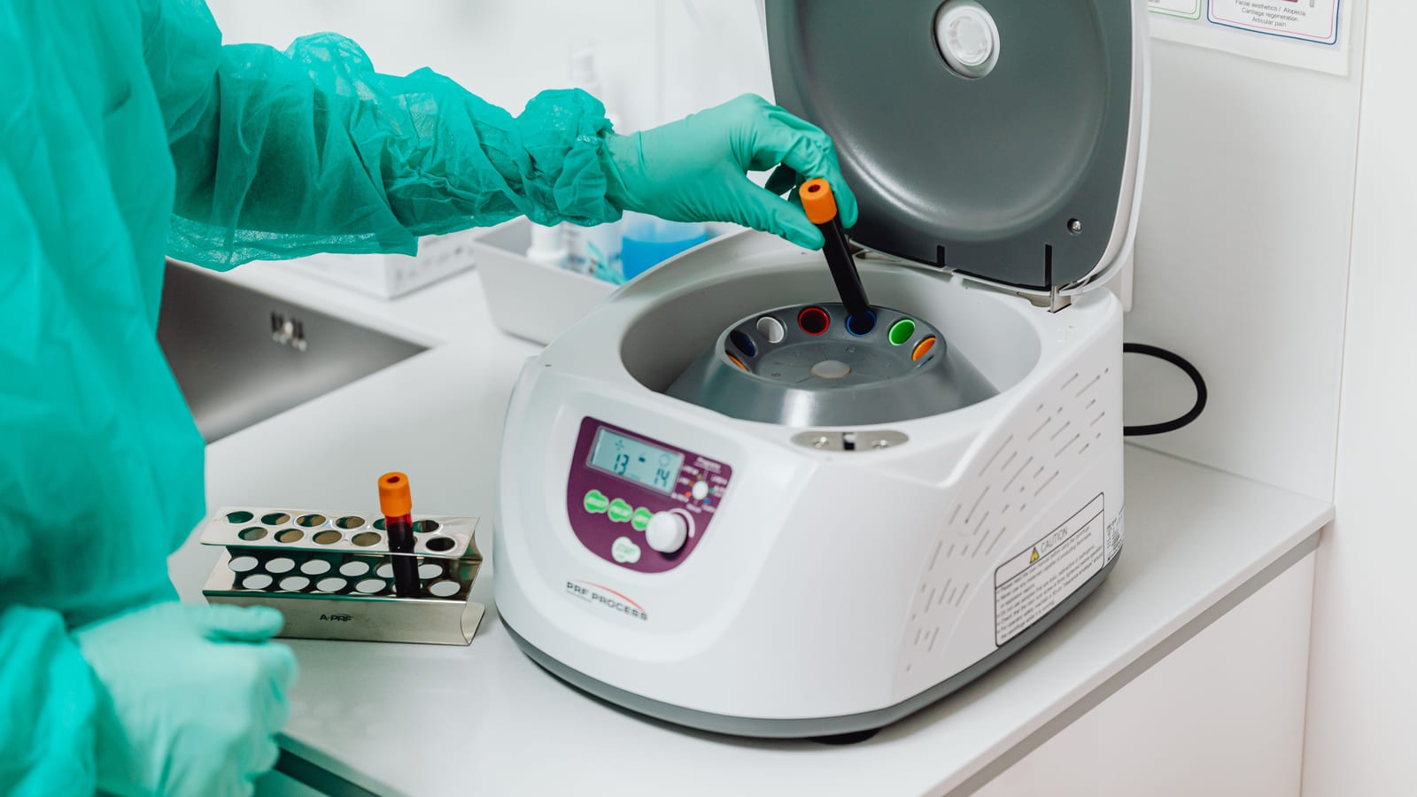 Benchtop centrifuge and collection tubes in a clinic laboratory — does prp for hair loss work? evidence at OC Weight Loss &