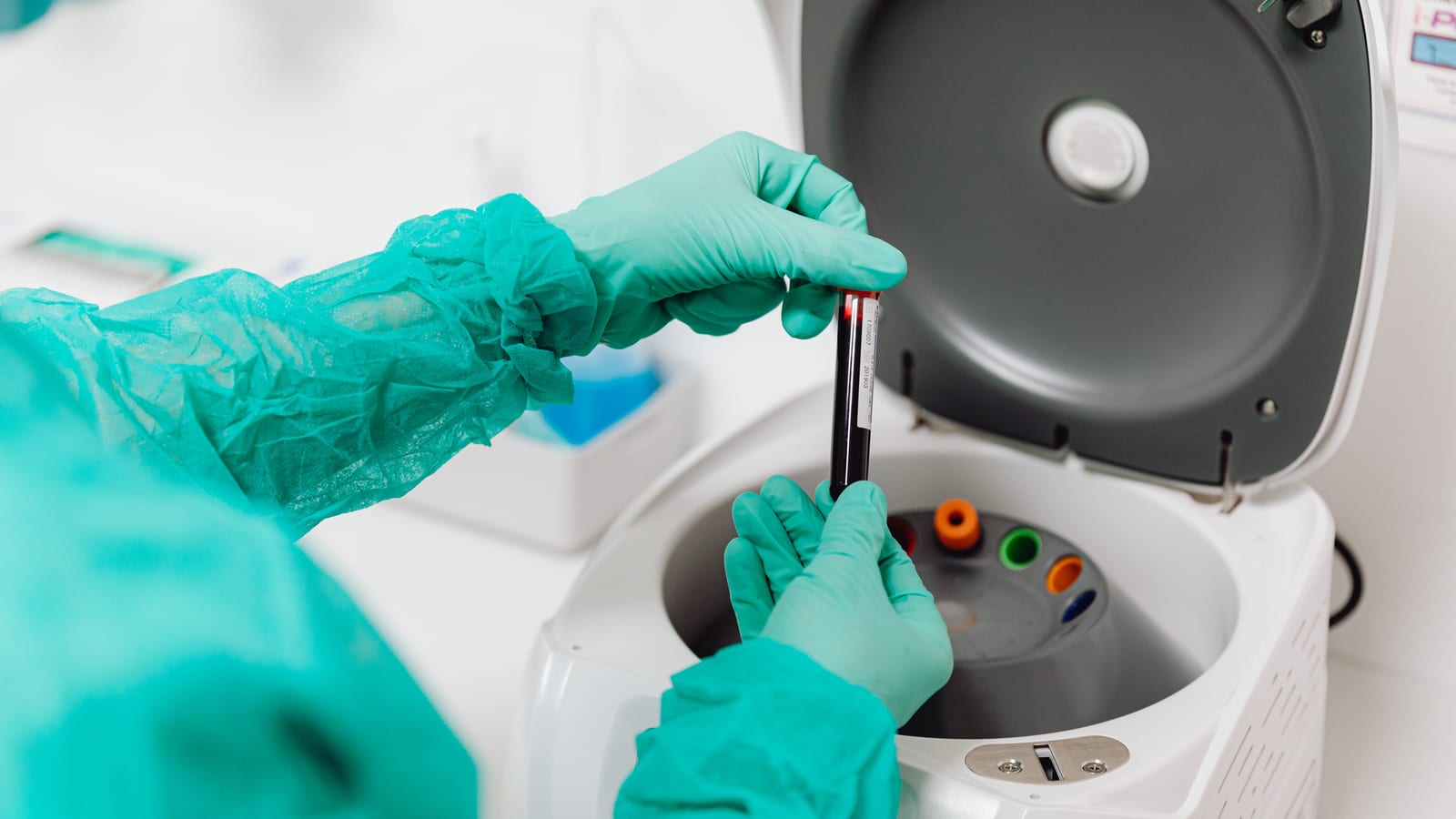 Benchtop centrifuge and collection tubes in a clinic laboratory — prp 's hair loss at OC Weight Loss & Med Spa, Mission Viejo