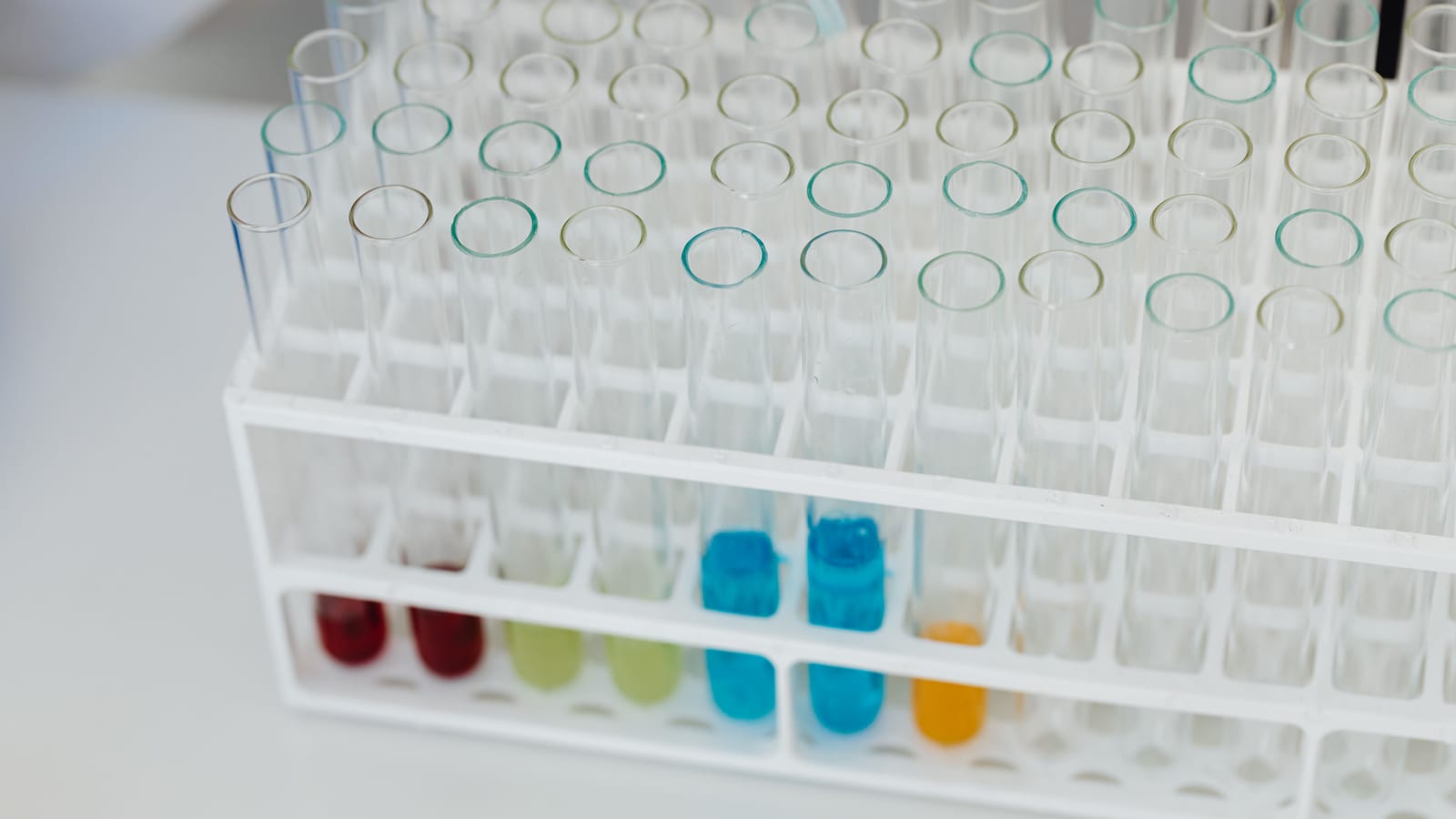 Benchtop centrifuge and collection tubes in a clinic laboratory — prp therapy in irvine at OC Weight Loss & Med Spa, Mission
