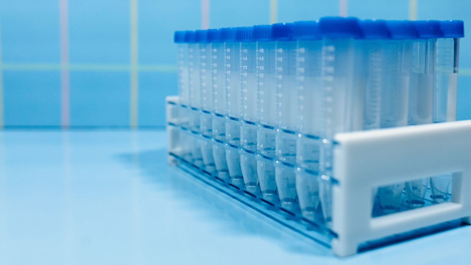 Benchtop centrifuge and collection tubes in a clinic laboratory — prp vampire facial at OC Weight Loss & Med Spa, Mission