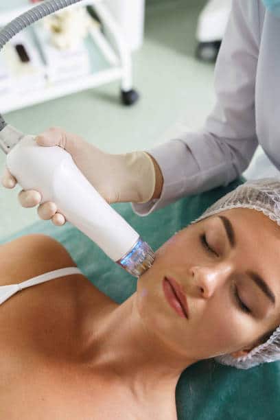 RF microneedling for facial contouring and skin tightening at OC Weight Loss and MedSpa
