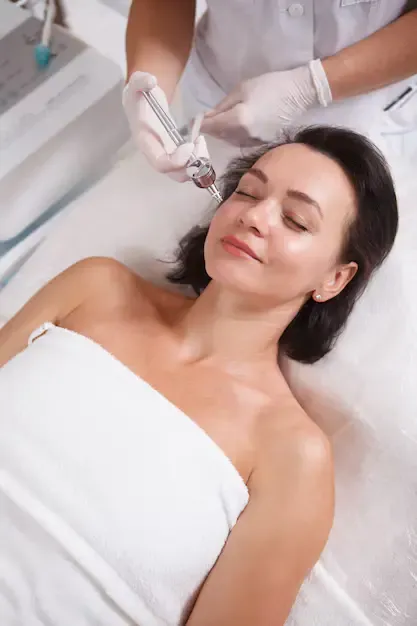RF microneedling for collagen production and skin tightening at OC Weight Loss and MedSpa