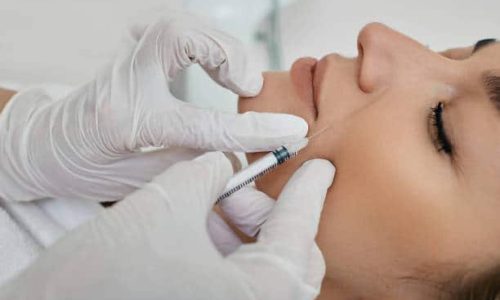 sculptra Service